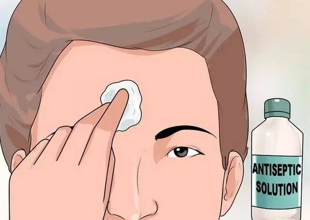 黑头痘痘粉刺脓包囊肿去除过程,脸上频繁长脓包痘痘是什么原因