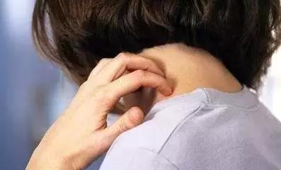 水槽里出现这种像蚂蟥的软体虫，真的得注意了！