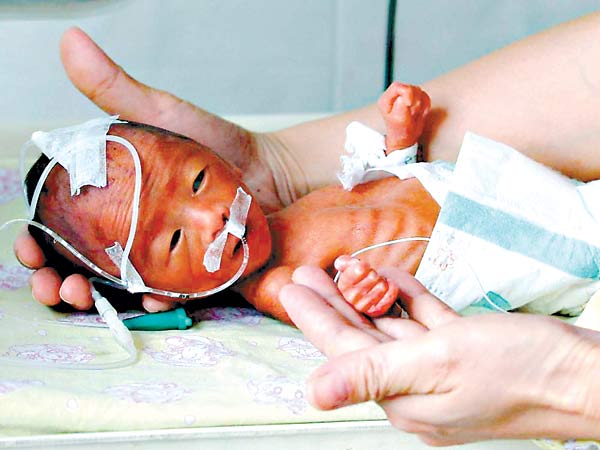 如何检测胎动是否正常,摸肚子听胎动