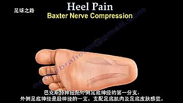 足跟痛最常见病因,足跟痛警惕四种疾病