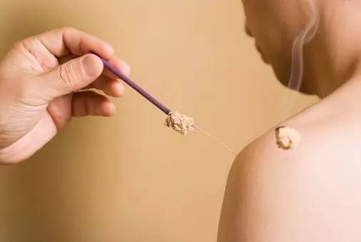 三伏天古法艾灸冬病夏治,三伏天冬病夏治如何艾灸