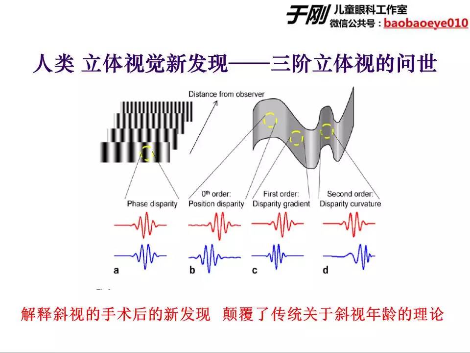 近视弱视斜视培训,弱视斜视课程