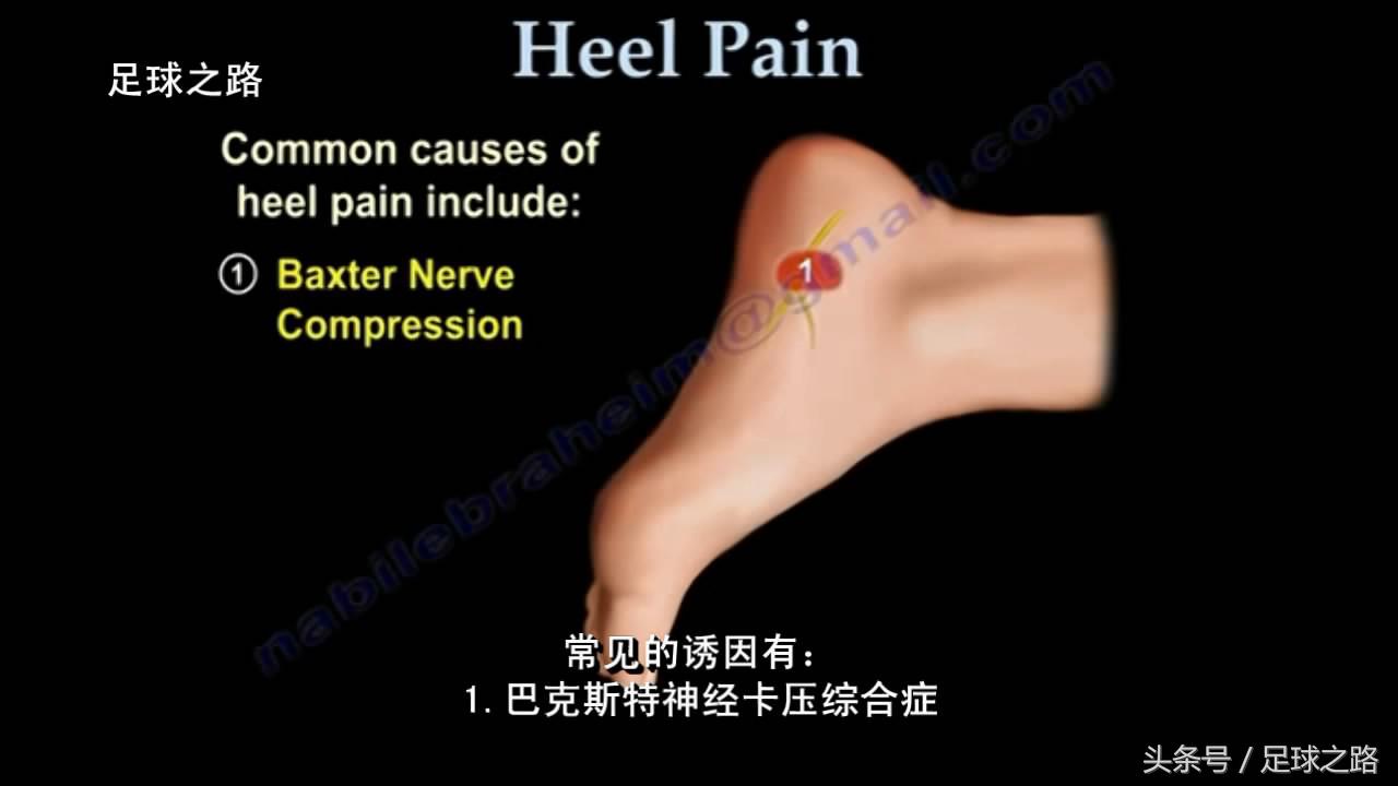 足跟痛的症状及表现,足跟痛最常见病因