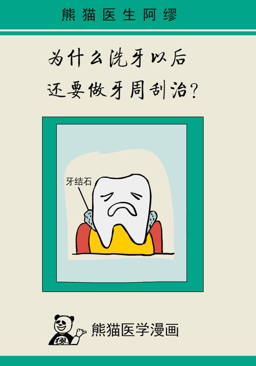 为什么洗牙以后还要做牙周刮治,为什么洗牙后还要刮治