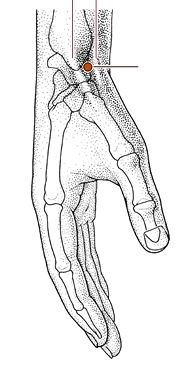 心烦失眠针灸,心烦针灸哪个穴位