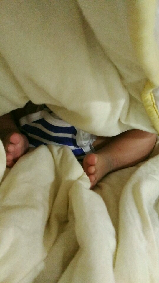 马蹄足内翻宝宝康复记，给相同经历的宝妈一些正能量