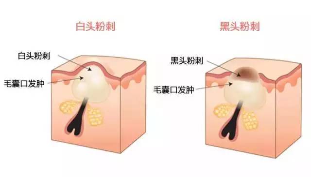 最新外国大战的场面,老外大战