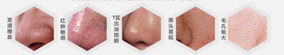 毛孔管理哪里可以做,毛孔管理臻美