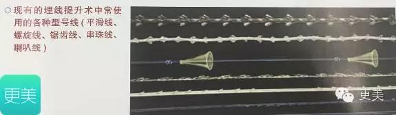 埋线美容线和不吸收线有什么区别,医院埋线和美容院埋线有什么差别