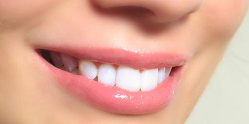 怎么消除牙黄牙垢,教你5分钟消除牙垢太实用了