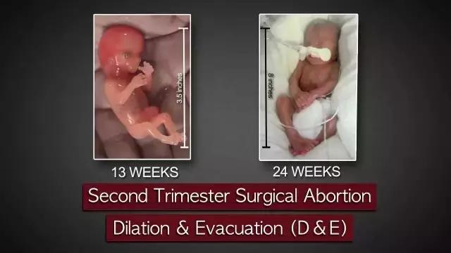 LAN《性、安全、录像带》