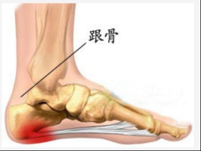 美国骨科协会氨糖,世界卫生组织治疗骨刺