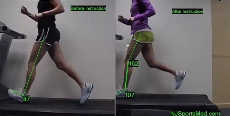 跑步机不伤膝盖跑法,听说跑步很伤膝盖真的吗