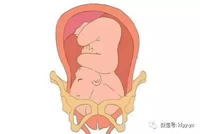 胎儿胎头较低该注意什么,分娩胎头下降的过程