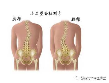 小针刀治疗脊柱侧弯,腰椎间盘突出脊柱侧弯的针刀治疗