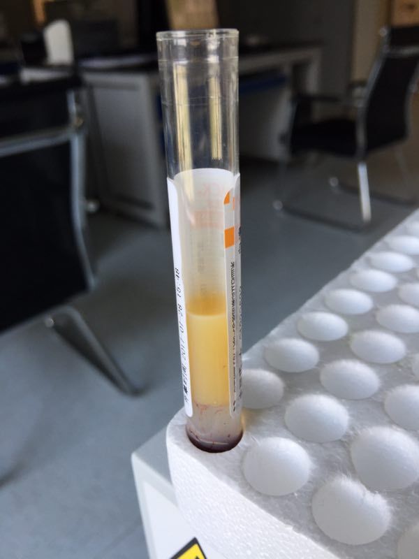 准妈妈们要注意了,准妈妈们这些孕期知识一定要注意