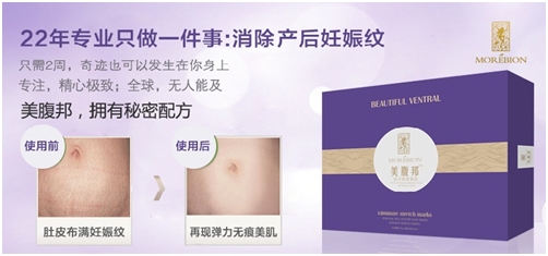 肥胖纹怎么淡化消除,肥胖纹可以消除掉吗