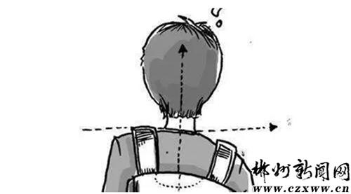 我终于可以昂首挺胸了!驼背男孩挺直了脊梁变翩翩少年