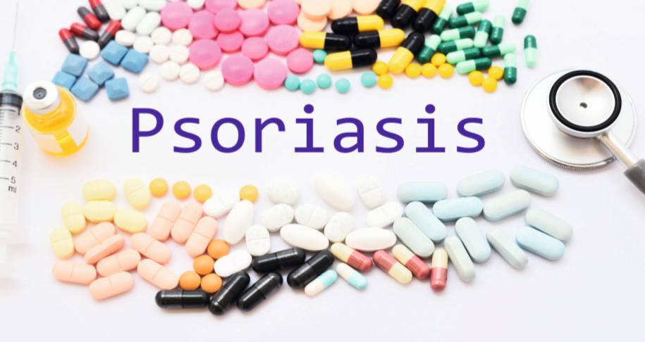 牛皮癣,屡治屡败怎么办?