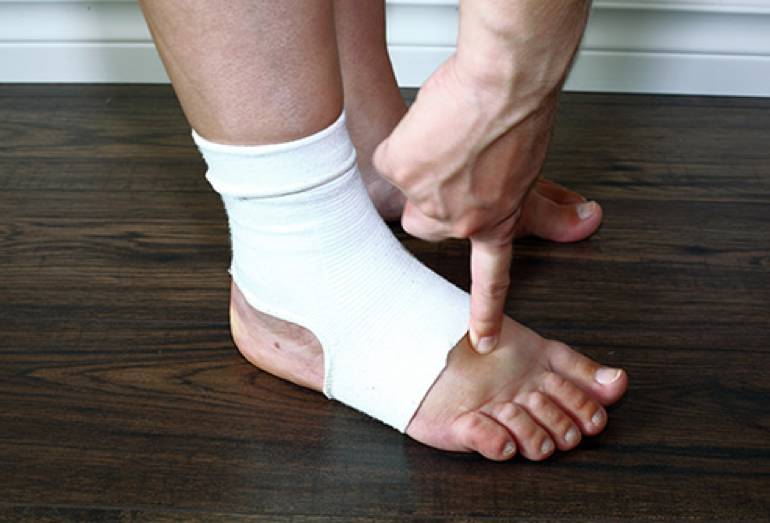 嘴肿了怎么办,水肿了怎么办