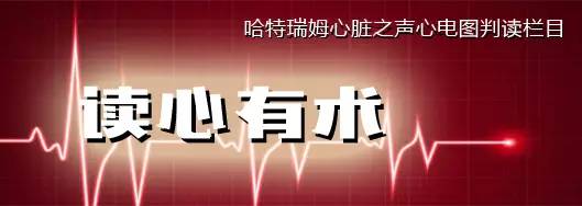 读心有术216,读心有术131期