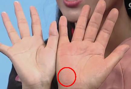 手上发红发紫是怎么回事,手部发青要警惕