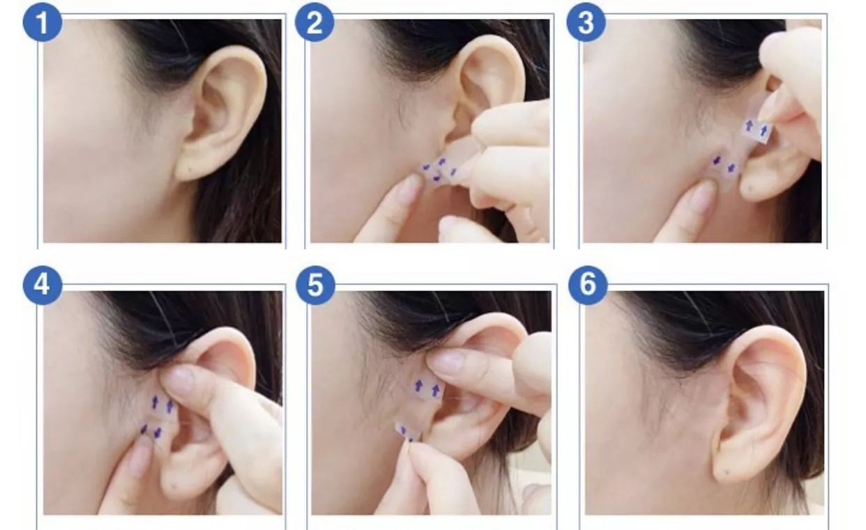 瘦脸不要跟风,瘦脸不走捷径是不可能的