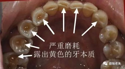 920爱牙日·牙齿酸软请心疼自己，80%的解决办法都在这里了，请自取