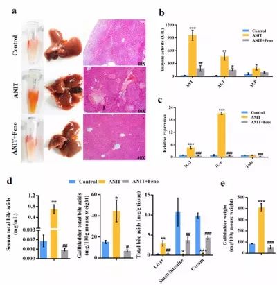胆汁淤积性肝病治疗专家共识pdf,胆汁淤积性肝病治疗