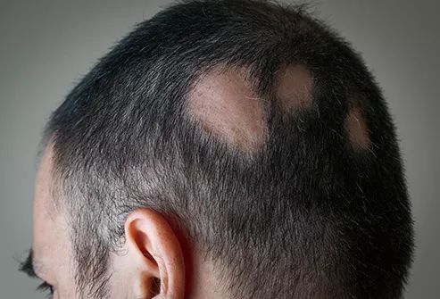 免疫系统出了问题是什么病,免疫系统出了问题会得什么病