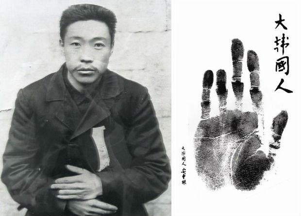 韩国人是不是有心理疾病,韩国人的主要疾病