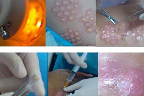 走红白癜风圈的神技，知道3样，你比宇文玥还厉害！