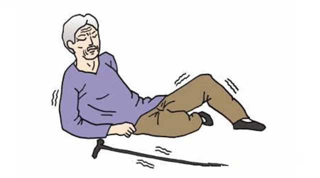 股骨粗隆间骨折的护理问题及措施,股骨粗隆骨折临床指南