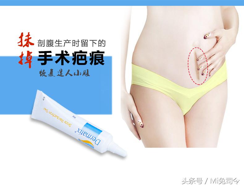 祛疤没有什么风险吧,疤痕祛疤最好的方法