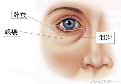 卧蚕要不要修,卧蚕要不要化高光