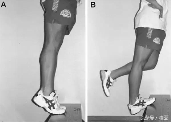 跟腱炎如何才能算是真正的好了,如果有跟腱炎应该怎么样练