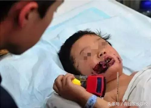 狗狗中暑缓解后还有危险吗,狗狗也会情绪低落吗