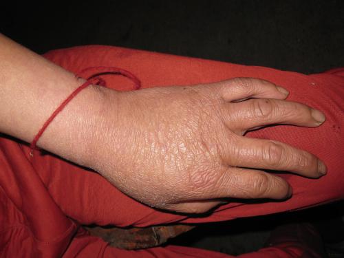 颈椎病只要不低头什么姿势都行吗,颈椎病在家就能搞定