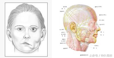面肌痉挛吃中药可以彻底治愈吗,面肌痉挛最好的治疗办法是什么