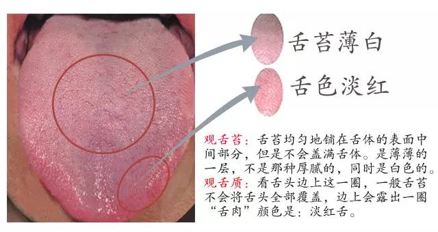 舌头是隐藏黑暗力量的钥匙，把舌头伸出来，跟着ZK叔学中医~