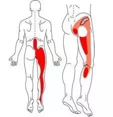 腰椎突出压迫坐骨神经痛怎么治疗,坐骨神经痛单侧屁股痛怎么治疗呢