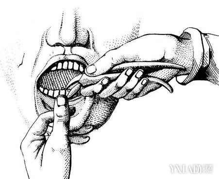 拔牙缝针后注意事项和禁忌,拔牙后注意事项和禁忌