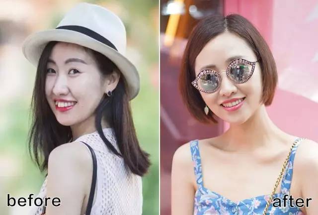 整牙戴的粉色的牙套,整牙给人带来的变化