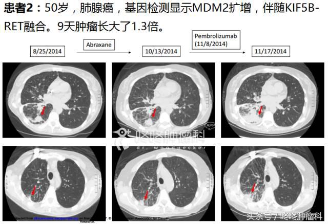 怎样知道pd-1治疗有效,怎么判断pd1免疫治疗有效