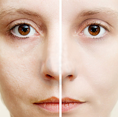 如何拯救毛孔粗大这篇科普说全了,毛孔粗大最简单有效的办法