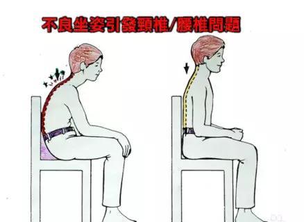 说这么多，你还敢坐着吗？为什么大夫总强调你起来活动？危害这么