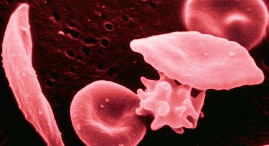 有像痣一样的小红点不痛不痒,身上长小红点像小白点