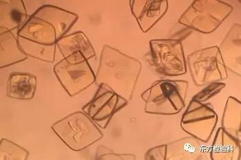 尿中结晶达到多少就是结石了,尿结晶数高是病吗