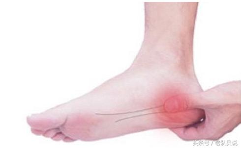 足跟痛的病因及治疗,中医认为足跟痛的病因是什么