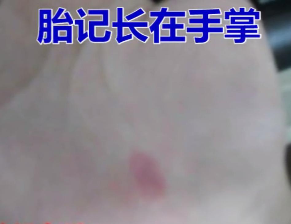 有这几个胎记的，男人出人头地，女人富贵一生，嫁入豪门！你有么